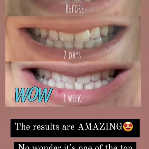 Whitening toothpaste! - Picture 6 of 11